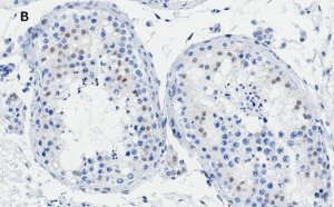 Anti-Androgen Receptor Antibody, clone 3K11 , ZooMAb Rabbit Monoclonal 