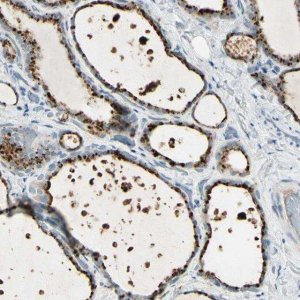 Anti-ANGPTL1 antibody produced in rabbit 