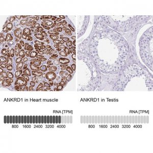 Anti-ANKRD1 antibody produced in rabbit 