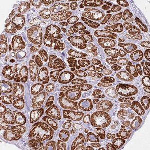Anti-ANKRD1 antibody produced in rabbit 
