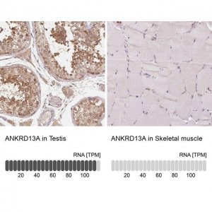 Anti-ANKRD13A antibody produced in rabbit 
