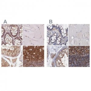 Anti-ANKRD13A antibody produced in rabbit 