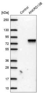 Anti-ANKRD13B antibody produced in rabbit 