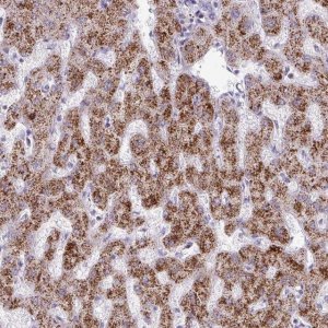 Anti-ANKRD13B antibody produced in rabbit 