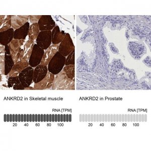 Anti-ANKRD2 antibody produced in rabbit 