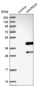 Anti-ANKRD23 antibody produced in rabbit 