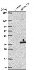 Anti-ANKRD29 antibody produced in rabbit 