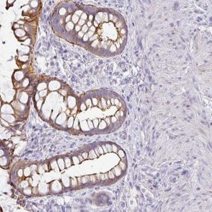 Anti-ANKRD29 antibody produced in rabbit 