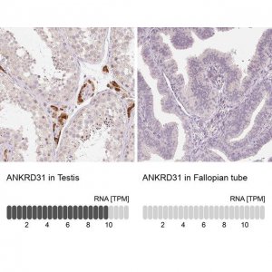 Anti-ANKRD31 antibody produced in rabbit 