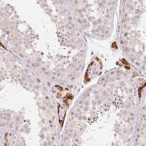 Anti-ANKRD31 antibody produced in rabbit 