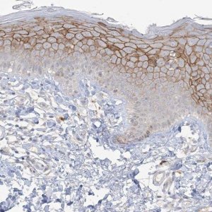 Anti-ANKRD35 antibody produced in rabbit 