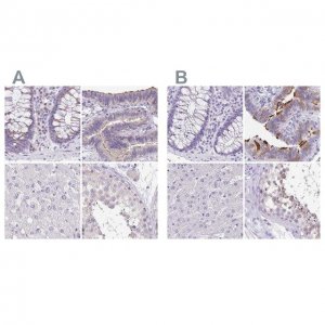 Anti-ANKRD45 antibody produced in rabbit 