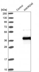 Anti-ANKRD45 antibody produced in rabbit 