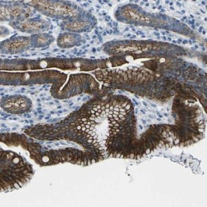 Anti-ANKRD46 antibody produced in rabbit HPA013758-100UL