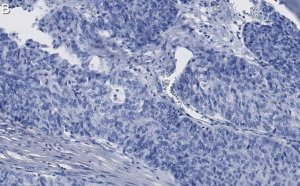 Anti-ANKZF1 Antibody, clone 1D4 ZooMAb Rabbit Monoclonal 