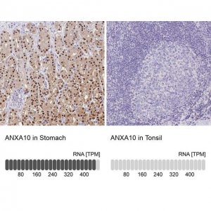 Anti-ANXA10 antibody produced in rabbit 