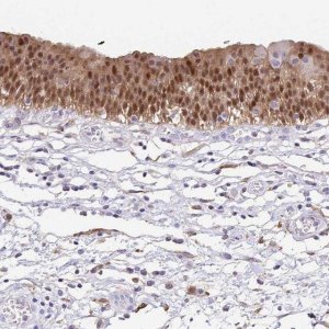 Anti-ANXA10 antibody produced in rabbit 