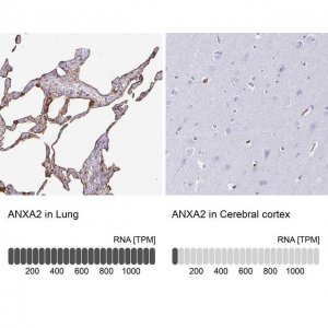 Anti-ANXA2 HPA046964-100UL
