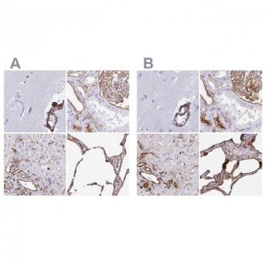 Anti-ANXA2 HPA046964-100UL