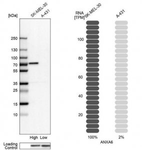 Anti-ANXA6 antibody produced in rabbit 