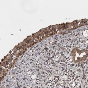 Anti-AOAH antibody produced in rabbit HPA026716-100UL