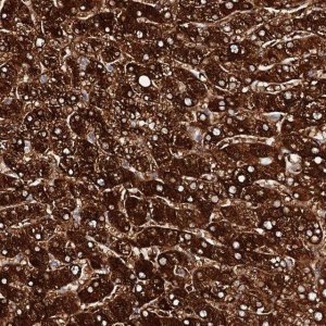 Anti-AOX1 antibody produced in rabbit 