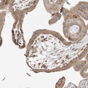 Anti-AP1AR antibody produced in rabbit 