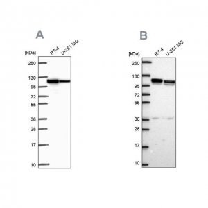 Anti-AP1B1 antibody produced in rabbit 