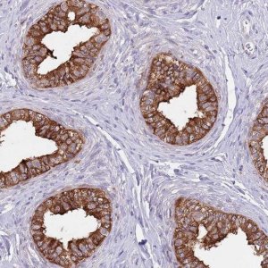 Anti-AP1S2 antibody produced in rabbit 
