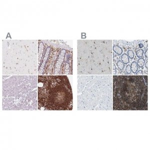 Anti-APBB1IP antibody produced in rabbit 