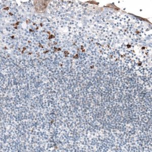 Anti-APOBEC3A antibody produced in rabbit 
