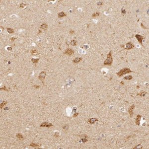 Anti-APP antibody produced in rabbit 