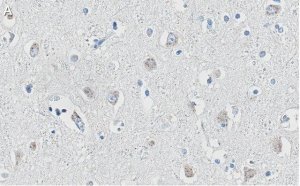 Anti-APP Antibody, clone 1F22 ZooMAb Rabbit Monoclonal 