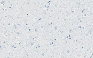 Anti-APP Antibody, clone 1F22 ZooMAb Rabbit Monoclonal 