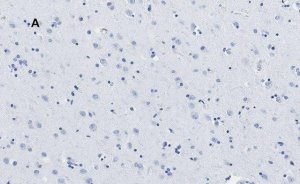 Anti-APP Antibody, clone 5D16, ZooMAb Rabbit Monoclonal 