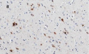 Anti-APP Antibody, clone 5D16, ZooMAb Rabbit Monoclonal 