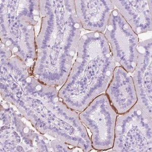 Anti-AQP10 antibody produced in rabbit 