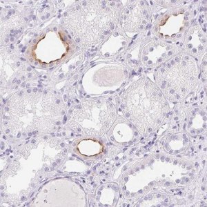 Anti-AQP2 antibody produced in rabbit 