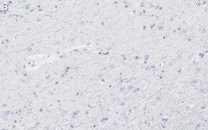 Anti-Aquaporin-4 Antibody, clone 1K2 ZooMAb Rabbit Monoclonal 