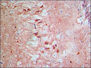 Anti-Arc (N-terminal) antibody produced in rabbit SAB4200461-200UL