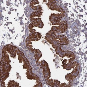 Anti-ARFIP1 antibody produced in rabbit 