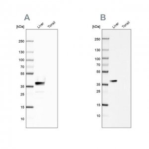 Anti-ARG1 antibody produced in rabbit 