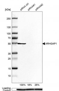 Anti-ARHGAP1 antibody produced in rabbit HPA004689-100UL