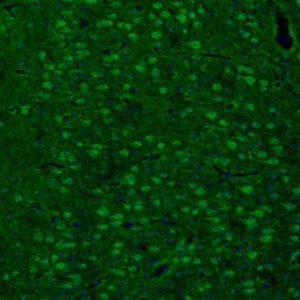 Anti-ARHGAP1 antibody produced in rabbit HPA004689-100UL