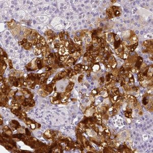 Anti-ARHGAP36 antibody produced in rabbit 