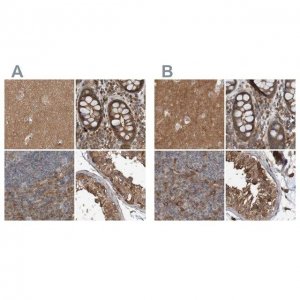 Anti-ARHGEF11 antibody produced in rabbit 
