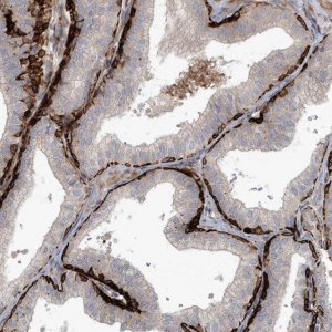 Anti-ARHGEF38 antibody produced in rabbit 