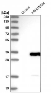 Anti-ARHGEF38 antibody produced in rabbit 