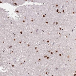 Anti-ARL14EP antibody produced in rabbit HPA048127-100UL