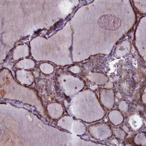 Anti-ARL15 antibody produced in rabbit 